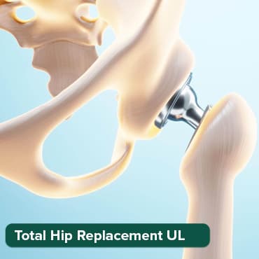 Arthroplastie totale de la hanche (unilatérale))