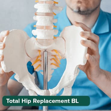 Total Knee Replacement-B/L